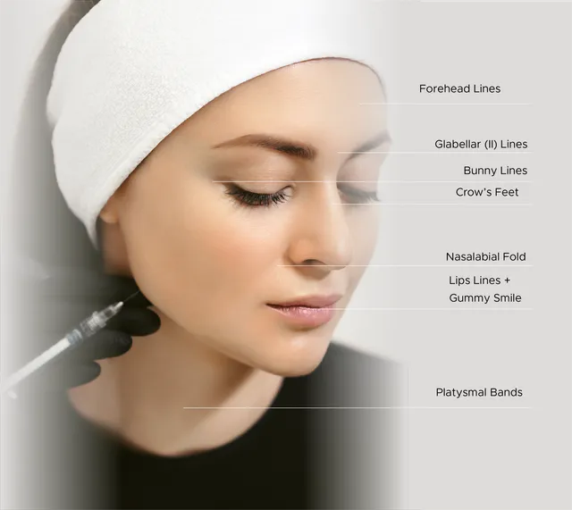 Botox+Treatment+Areas-640w