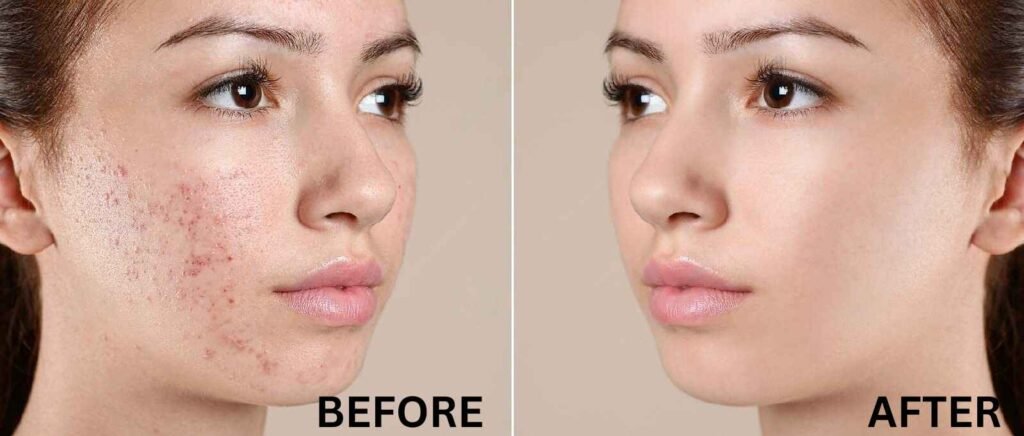 Medifacial treatment - Twacha aesthetic Skin Clinic