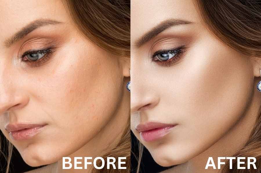 Pigmentation Treatment - Twacha Aesthetic Skin Clinic